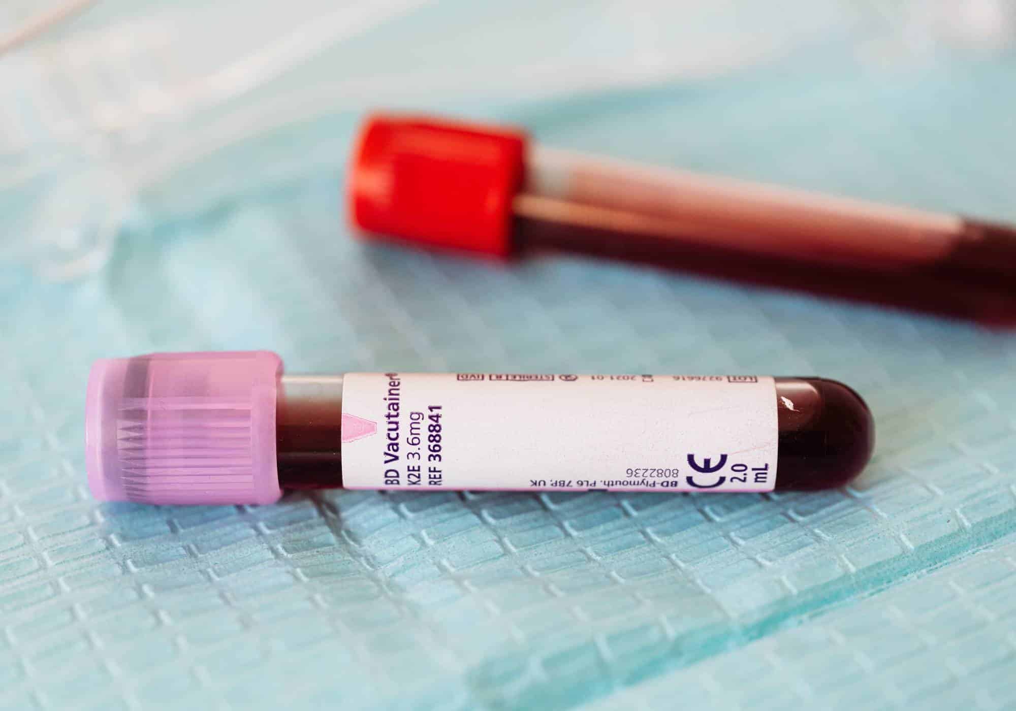 How Long Does Heroin Stay in Your System?