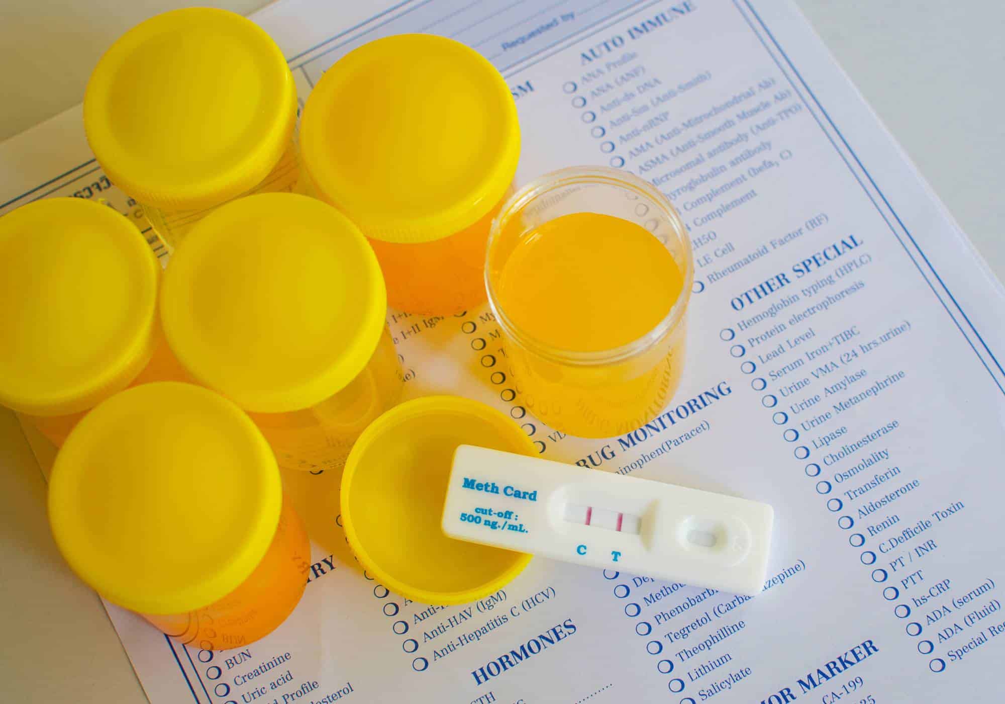 How Long Does Meth Stay in Your Body